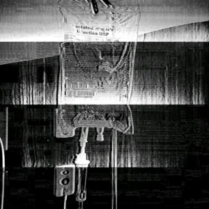 Black and white photo of IV bag in hospital emergency room. Image is animated with a glitch of lines.